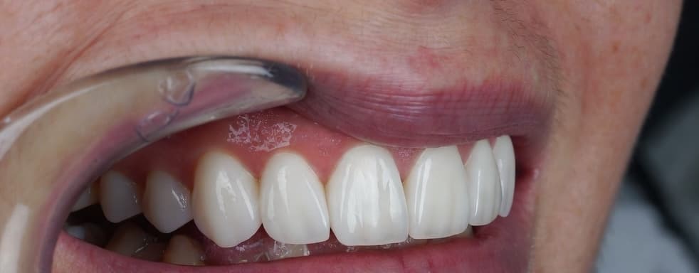 Premium Makeover - After