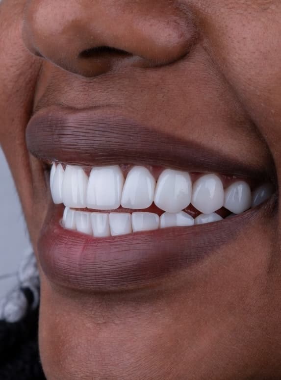 Advanced Transformation - After