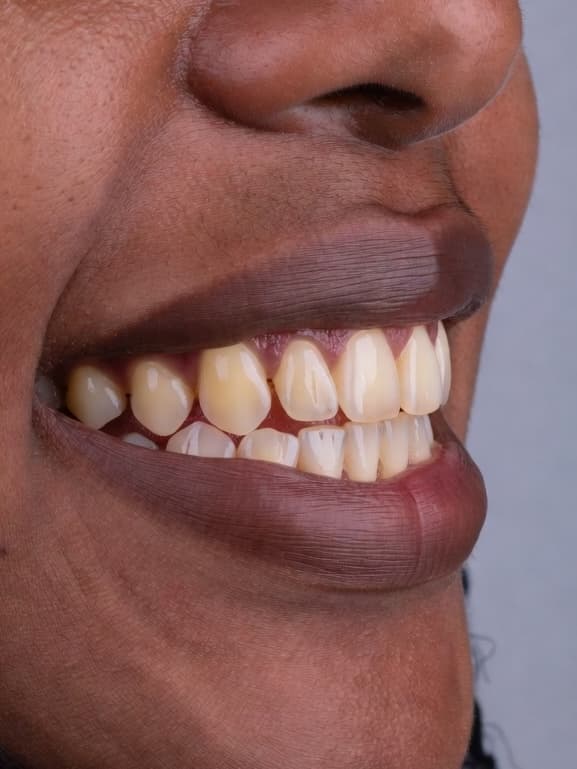 Advanced Transformation - Before